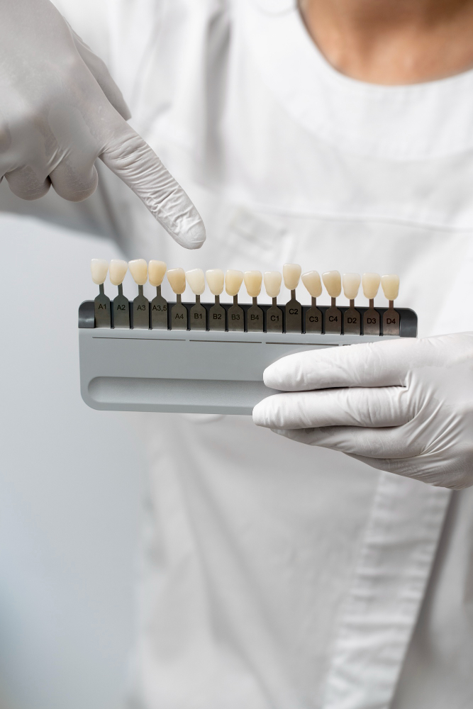 Composite Bonding