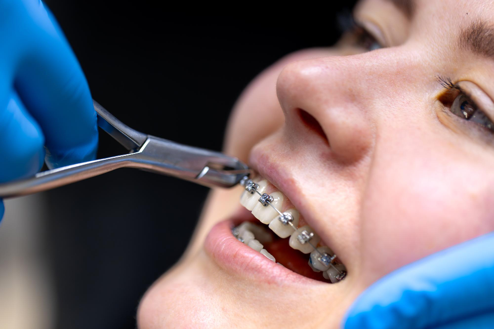 Orthodontic