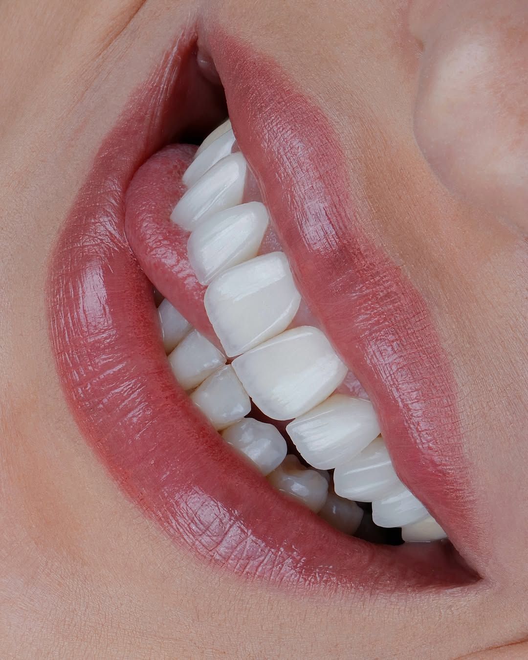 Smile Image