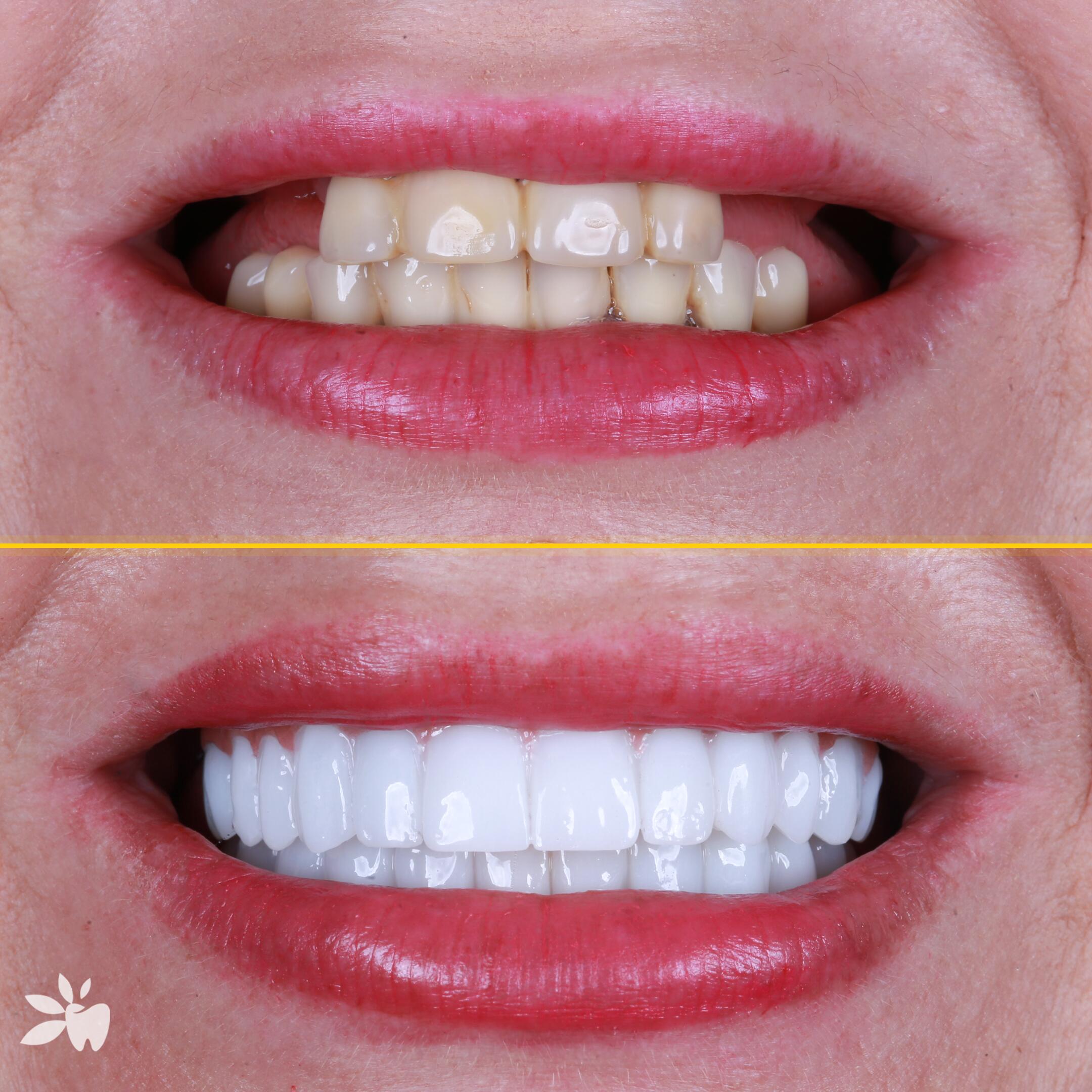 Agnieszka-Fierek-before-after-post