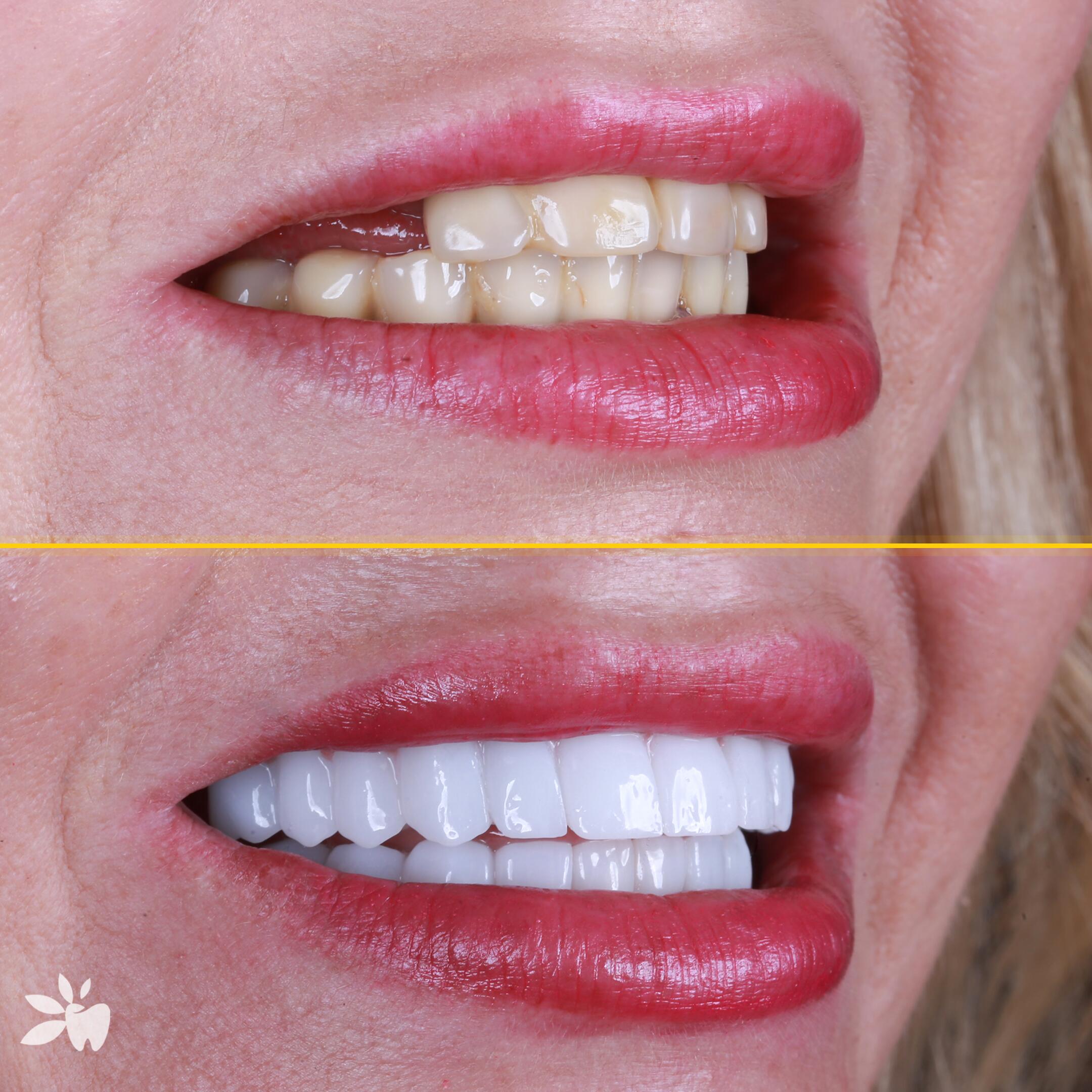 Agnieszka-Fierek-before-after-sag