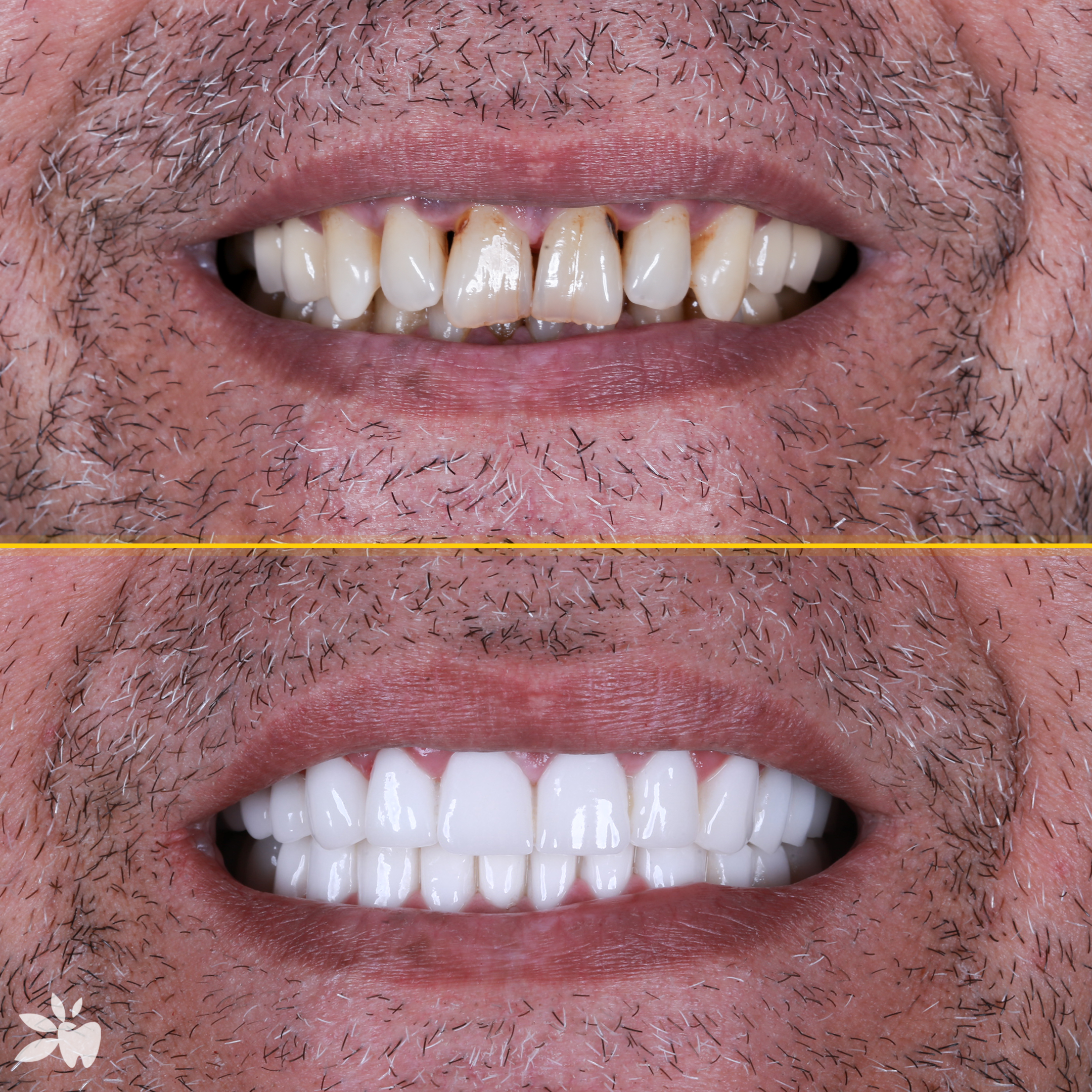 Ayhan-before-after-post
