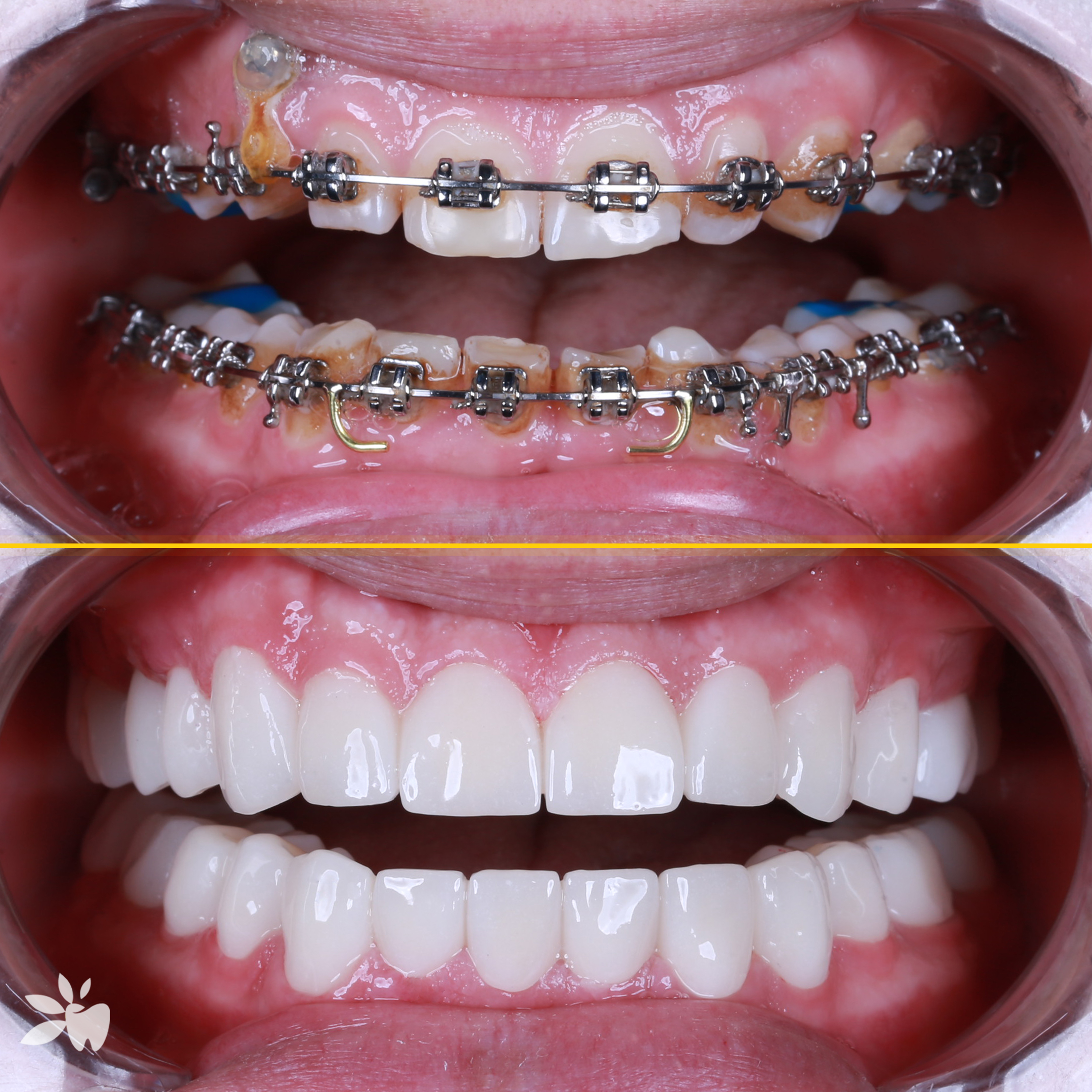 Borys-before-after-2