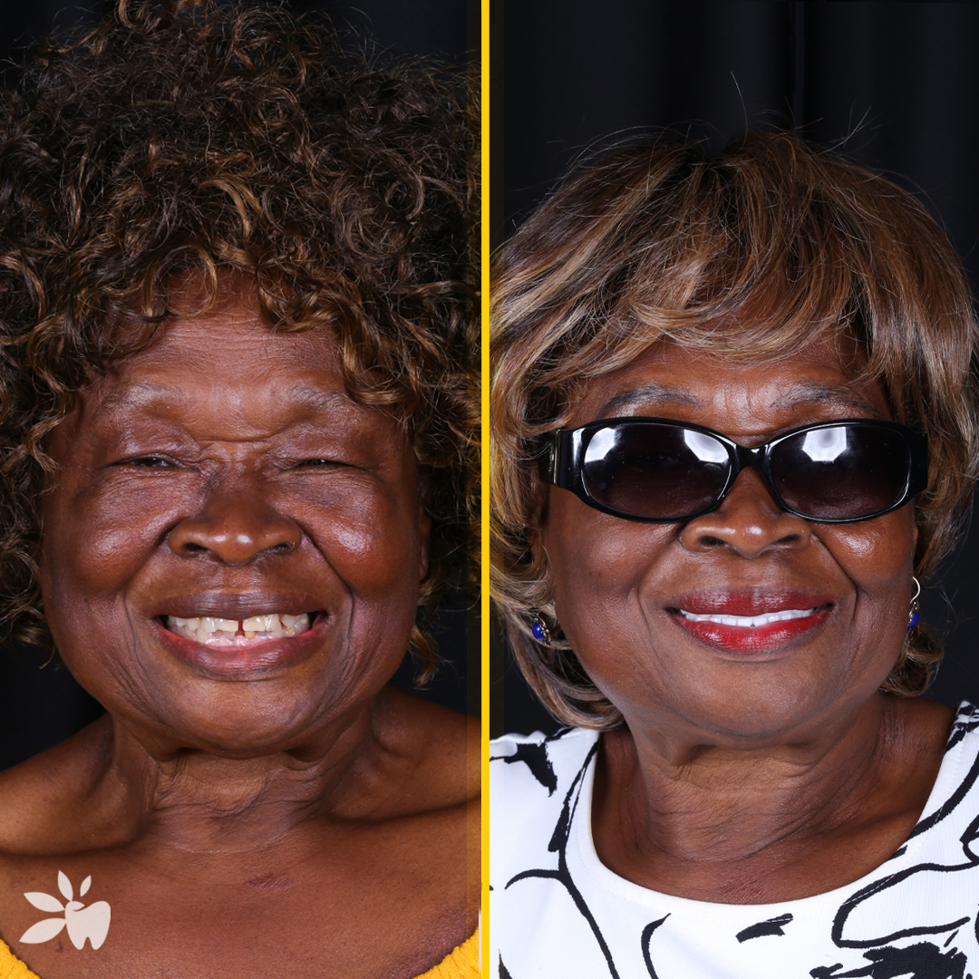 Claudian-before-after-face