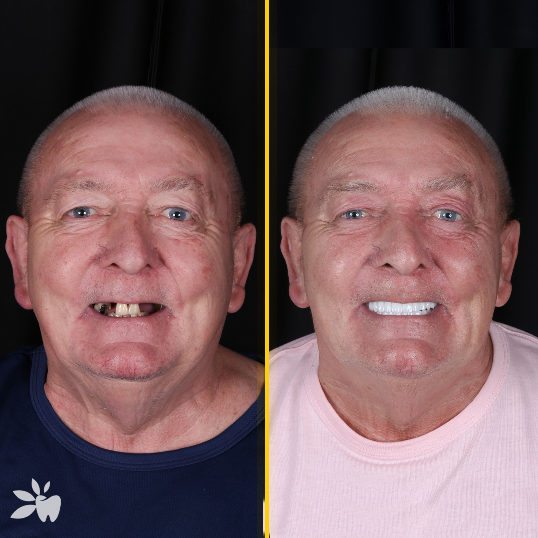 David-before-after-face