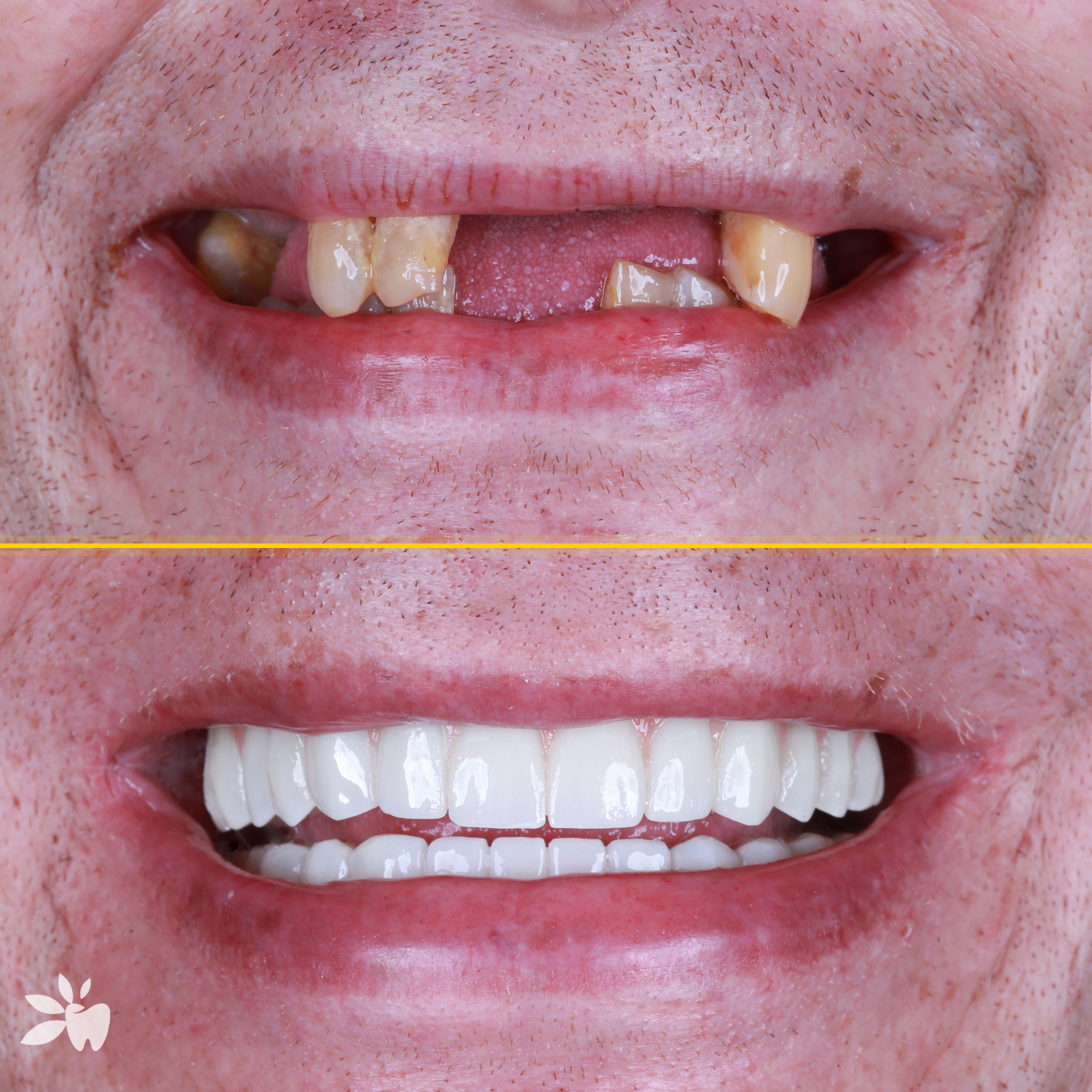Finbarr-before-after-post