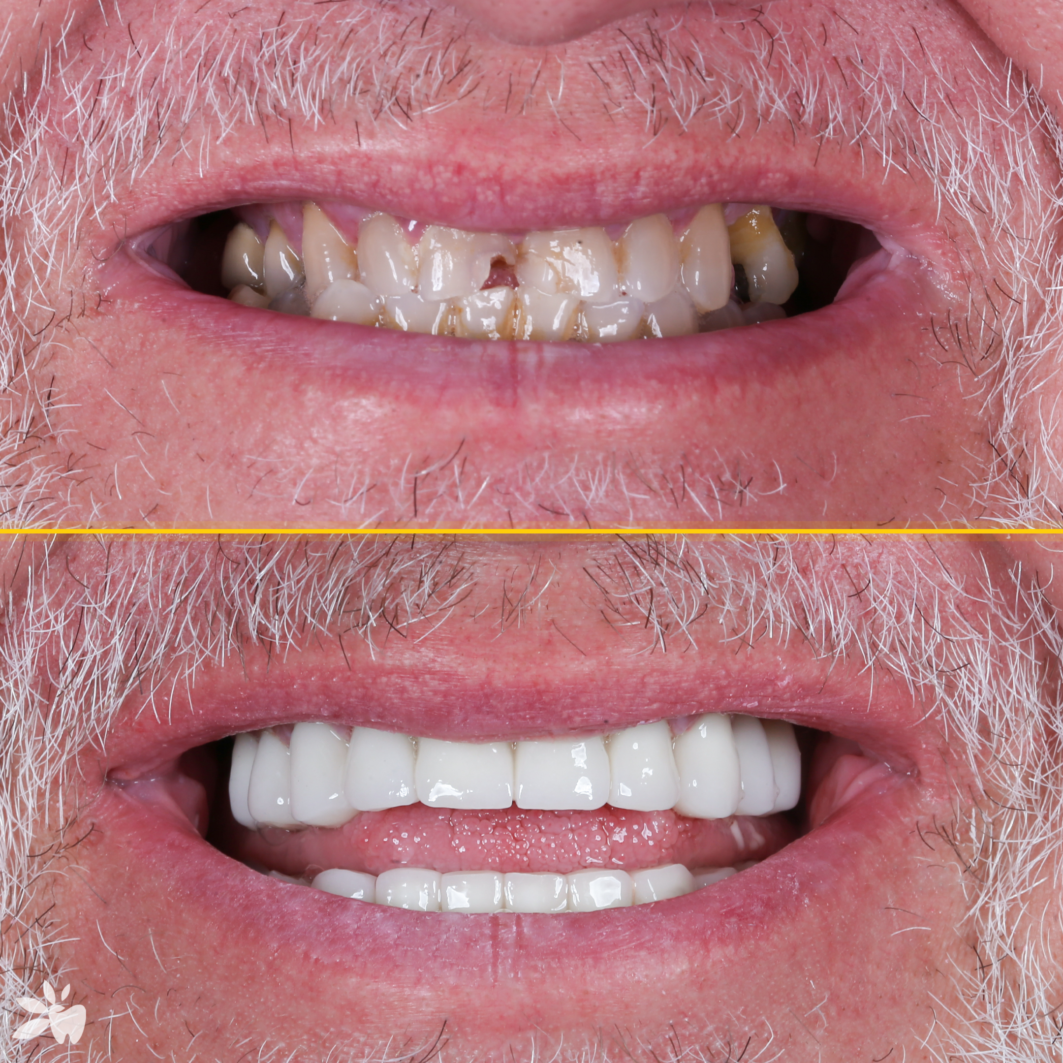 Gabriele-before-after