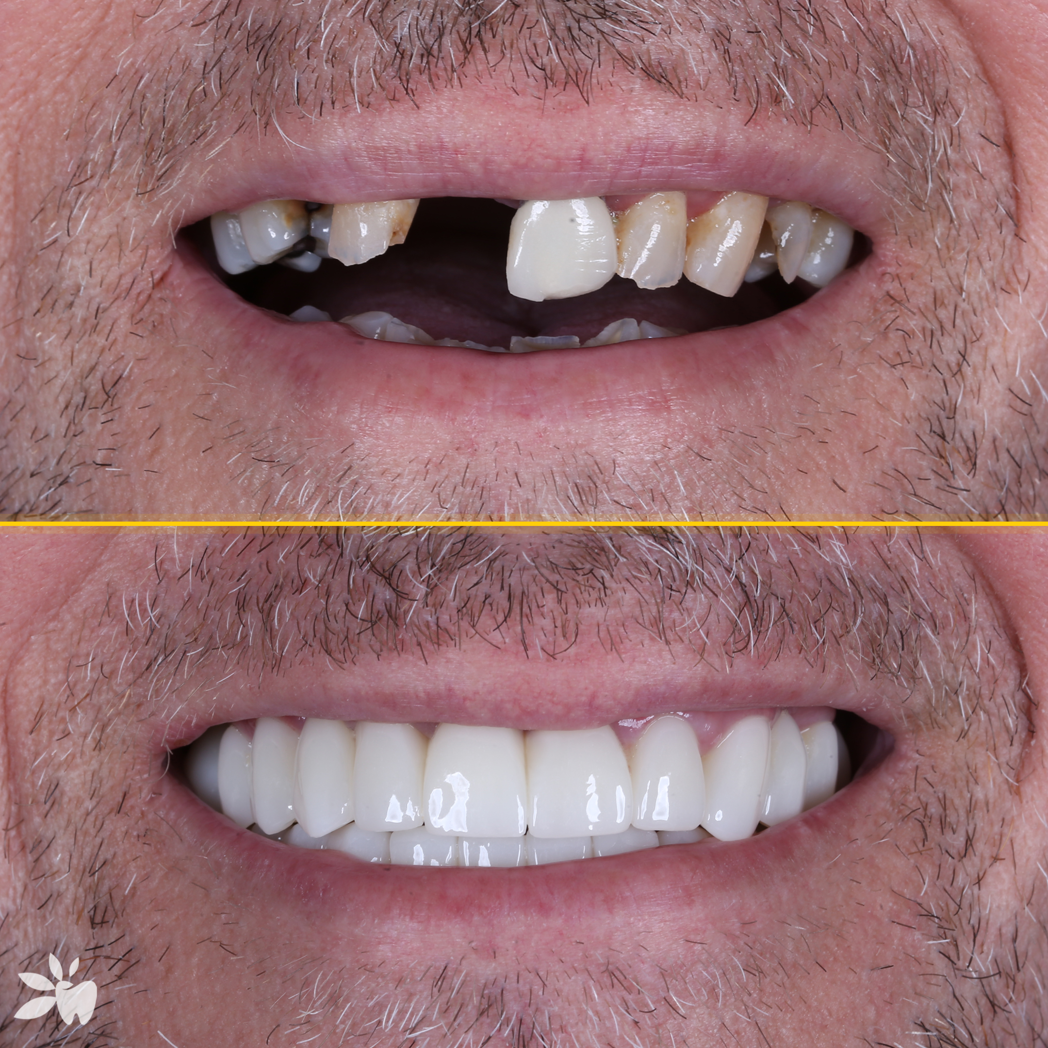 Graham-before-after-2
