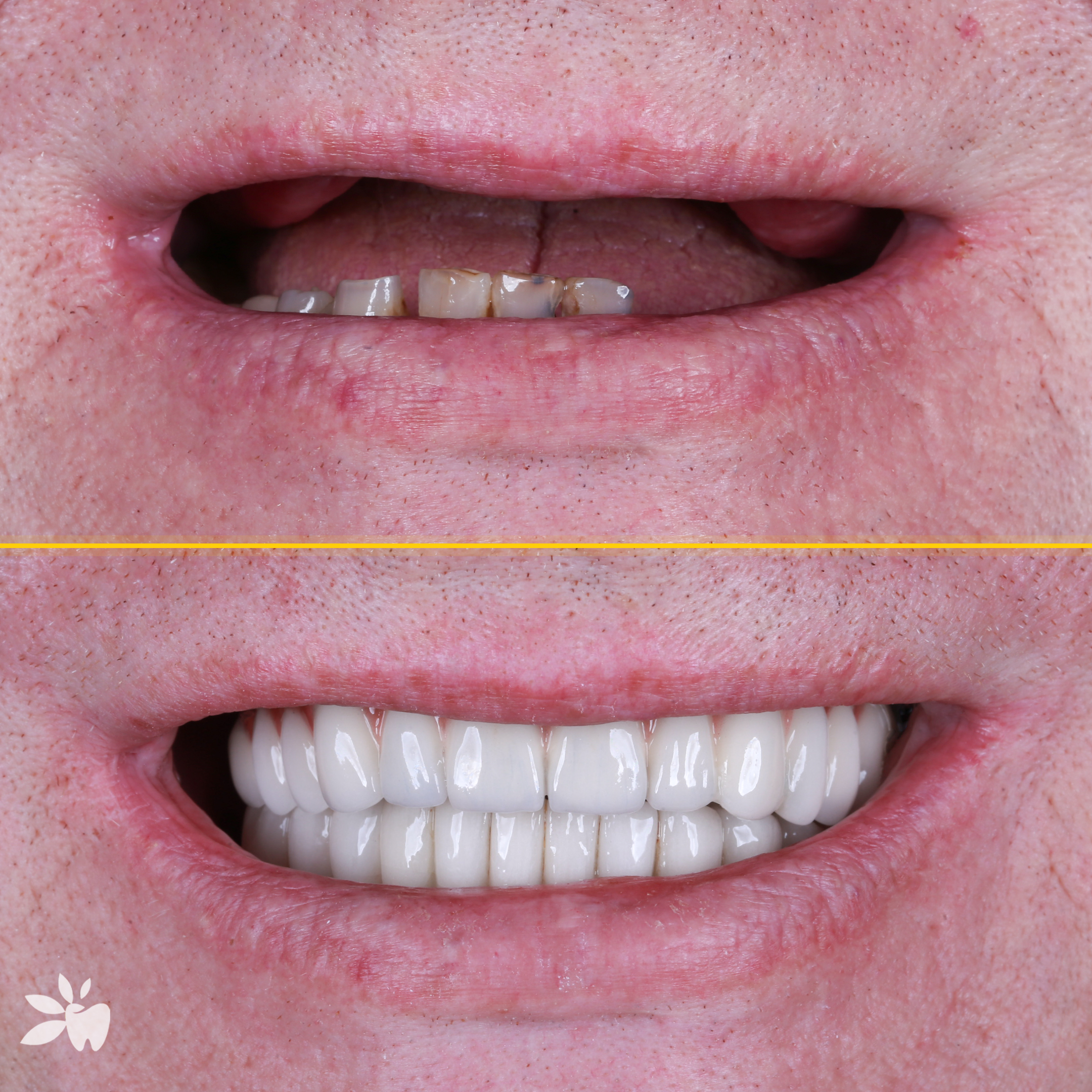 Hendrik-before-after-post