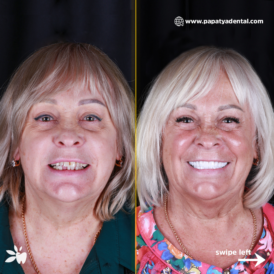 Irina-before-after-face
