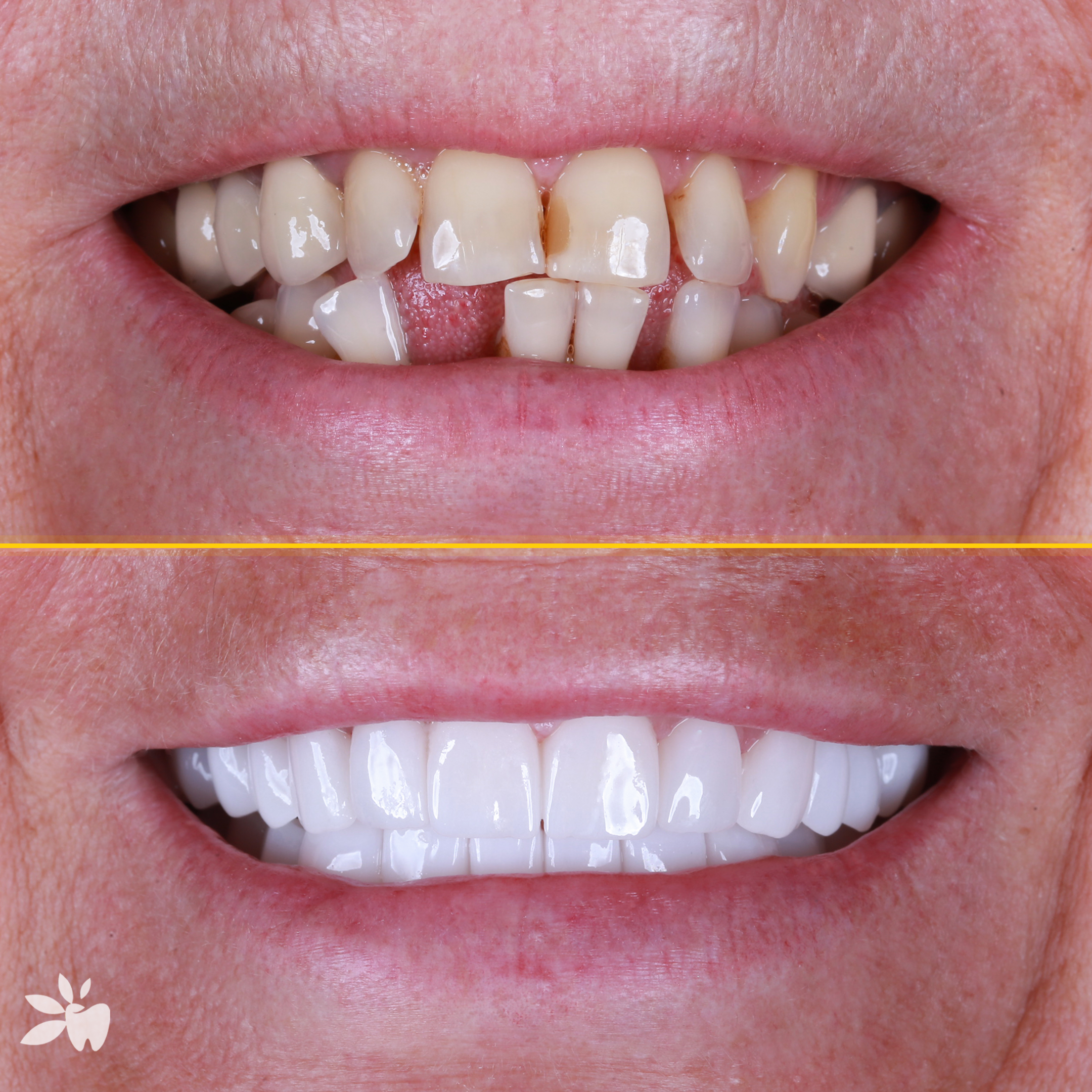 Irina-before-after-post