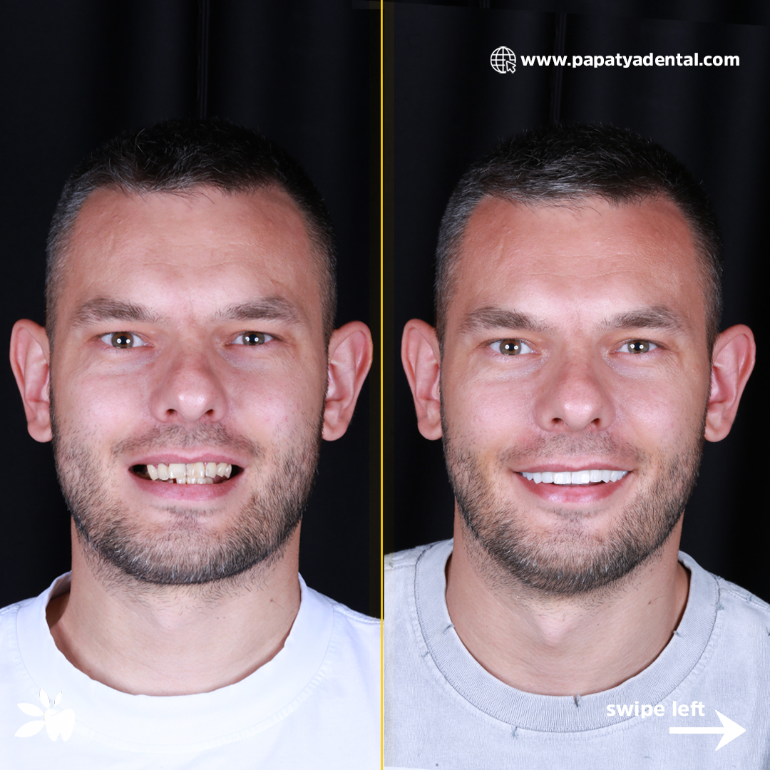 Karol-before-after-face