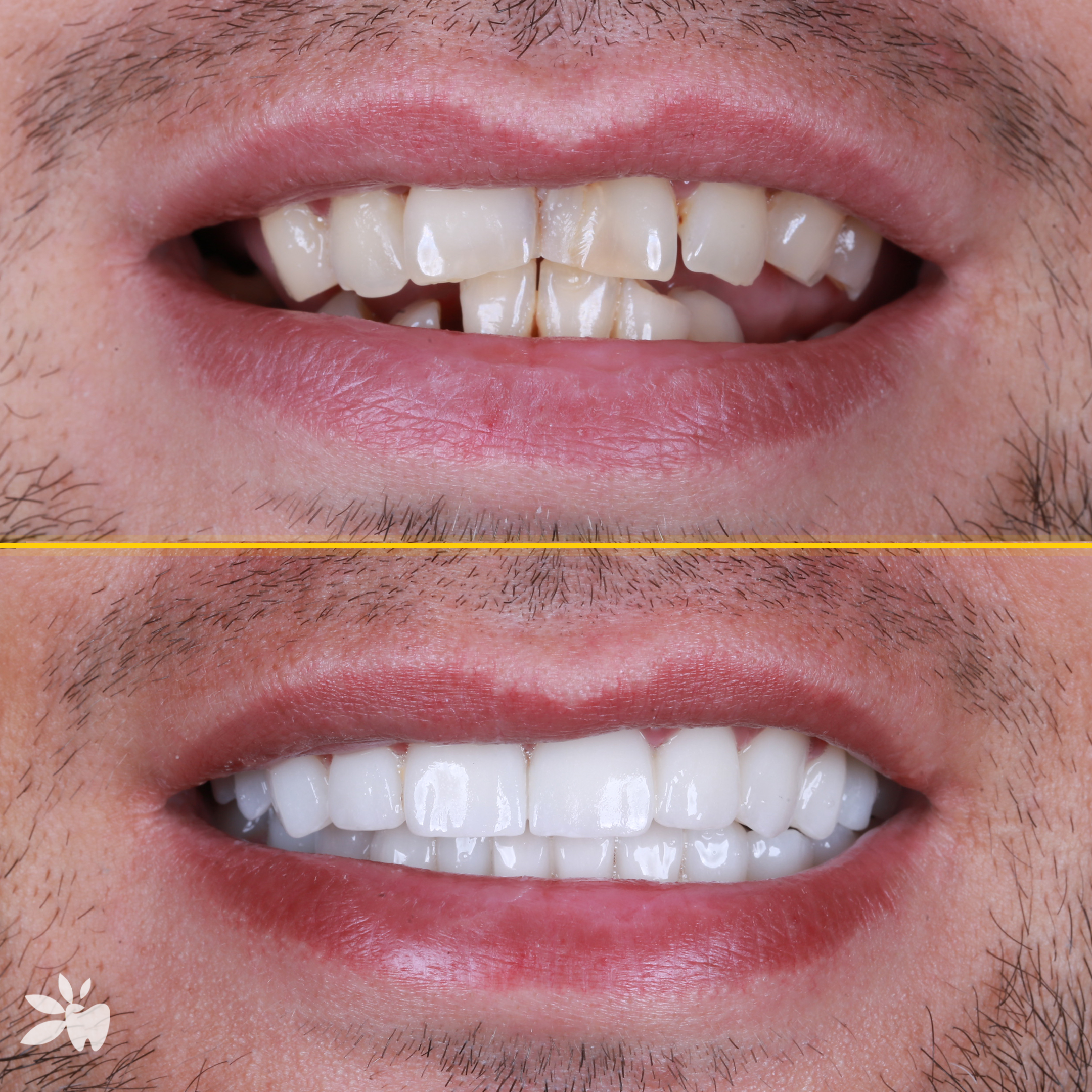 Karol-before-after-post