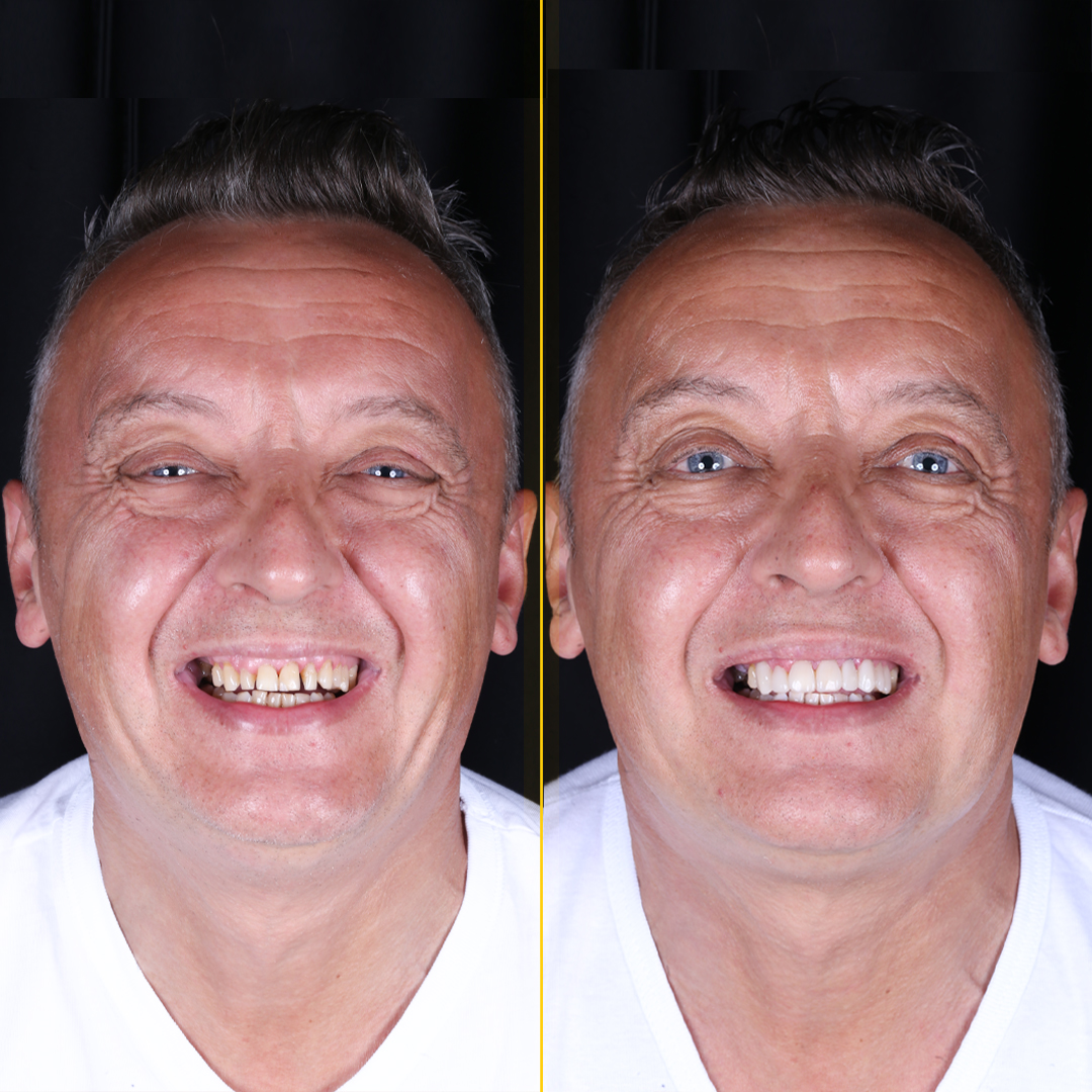 Marek-before-after-face