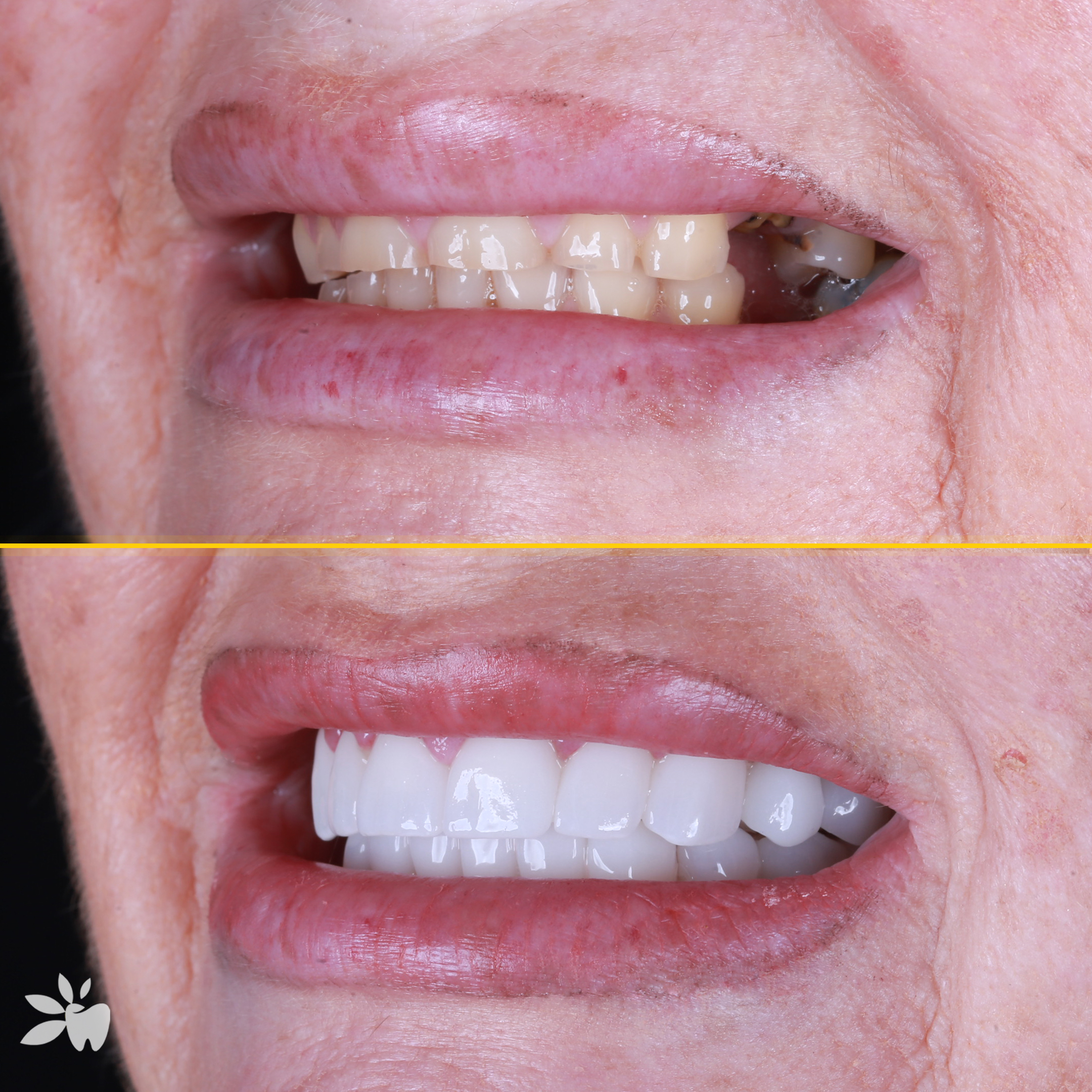 Maria-before-after-sol