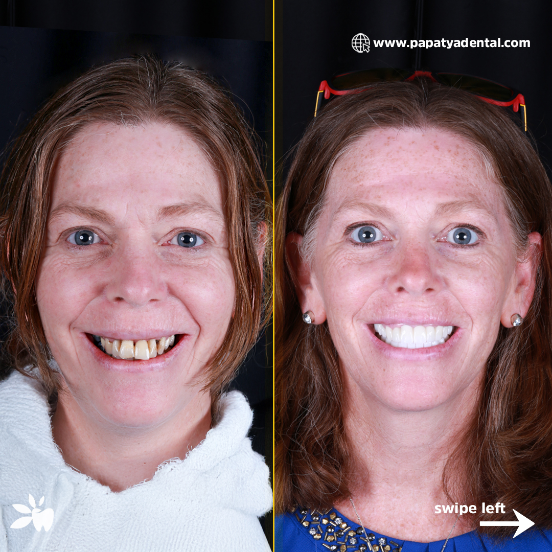 Marie-before-after-face-post