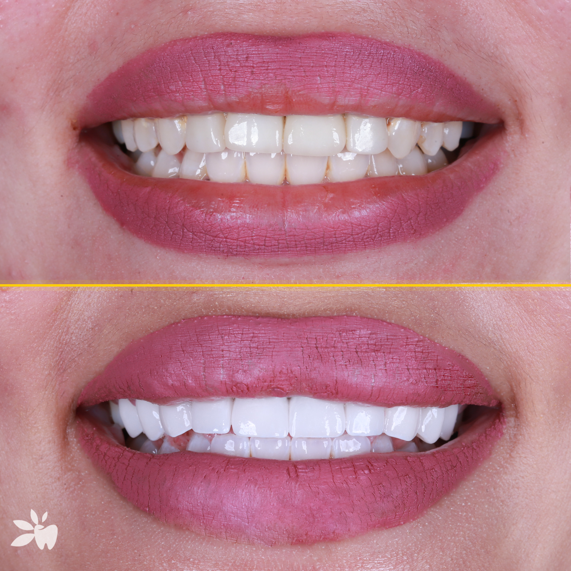 Mikayla-before-after-post