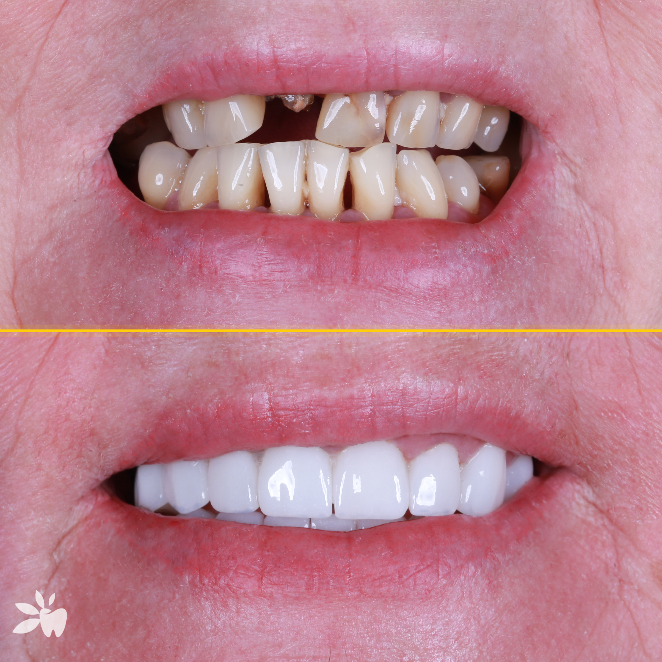 Olga-before-after-post