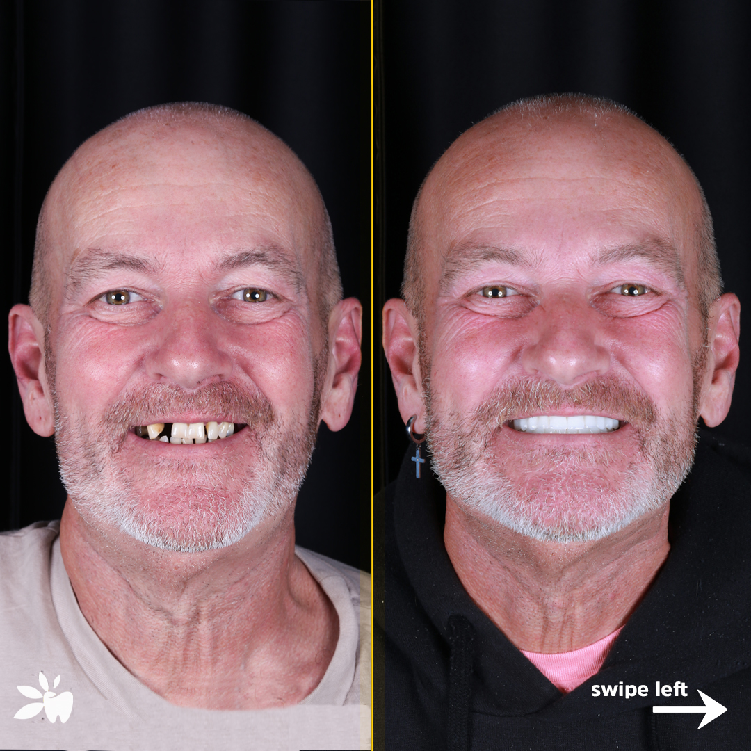 Steven-before-after-face