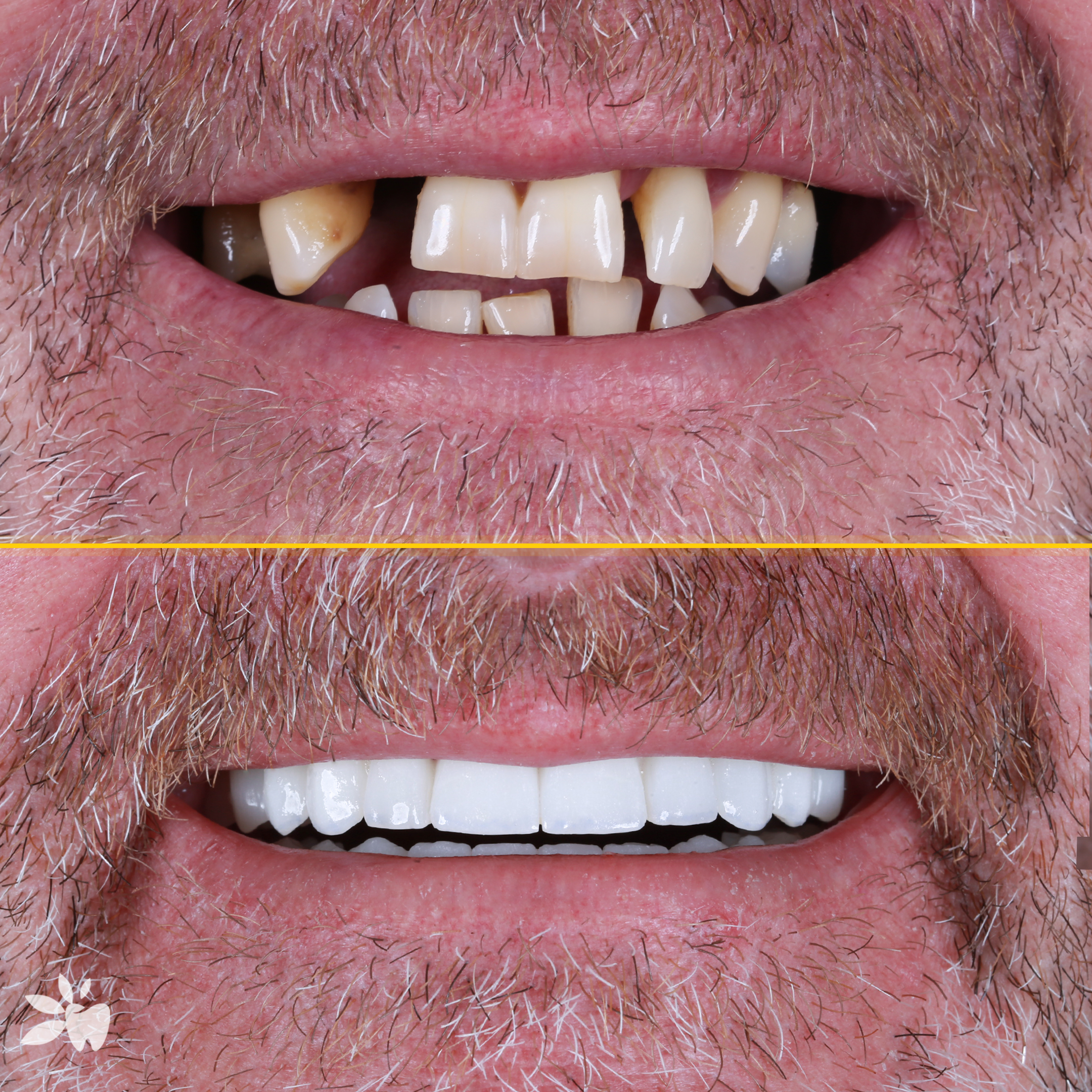 Steven-before-after-post