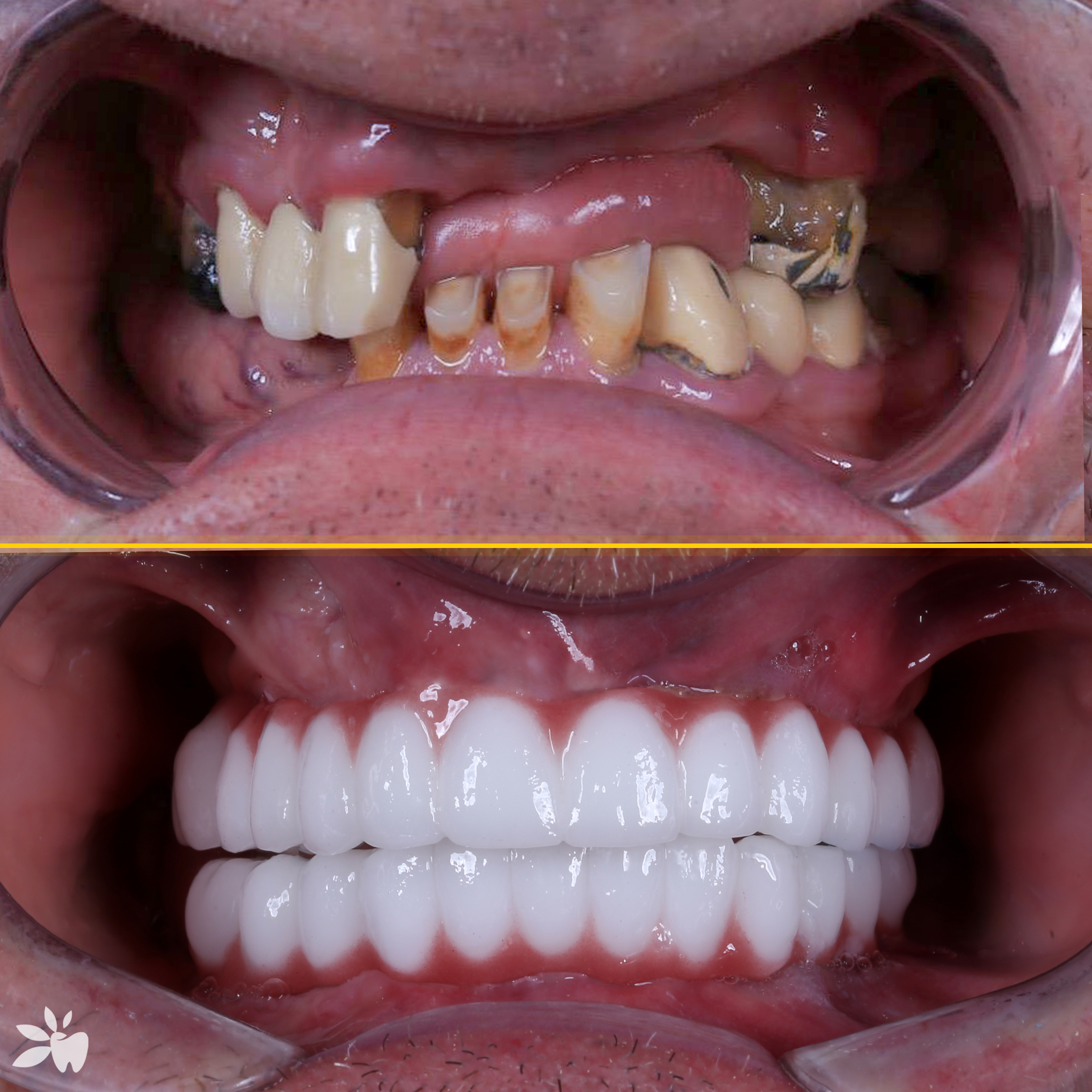Tiziano-before-after