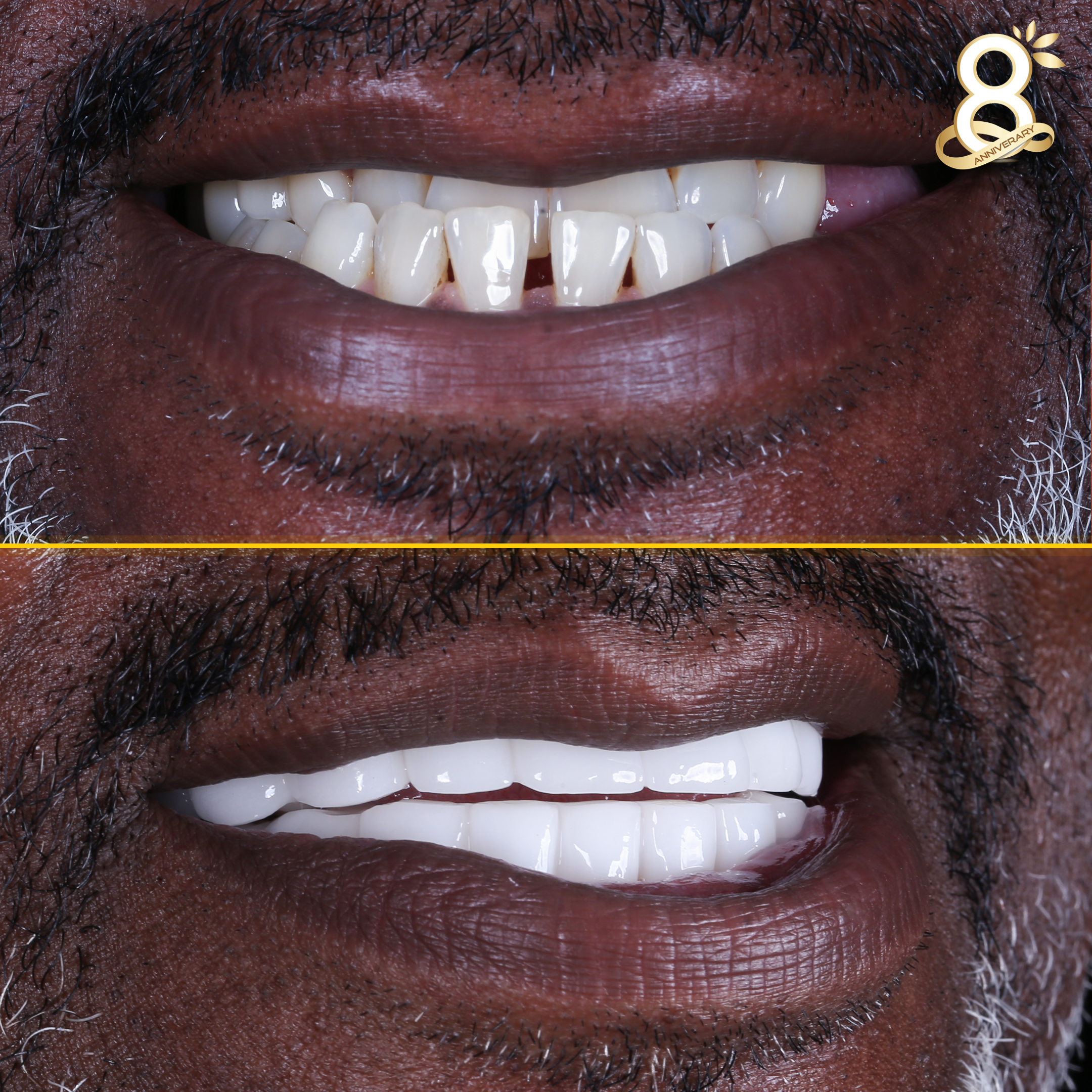 Tyrone-before-after-2