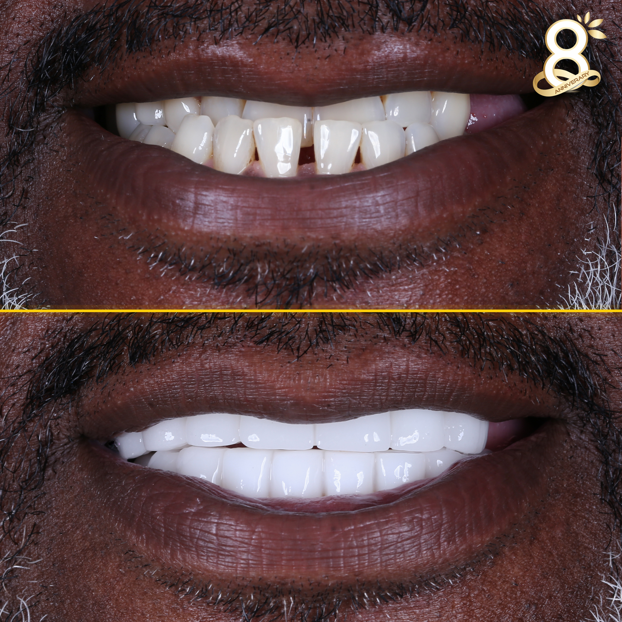 Tyrone-before-after
