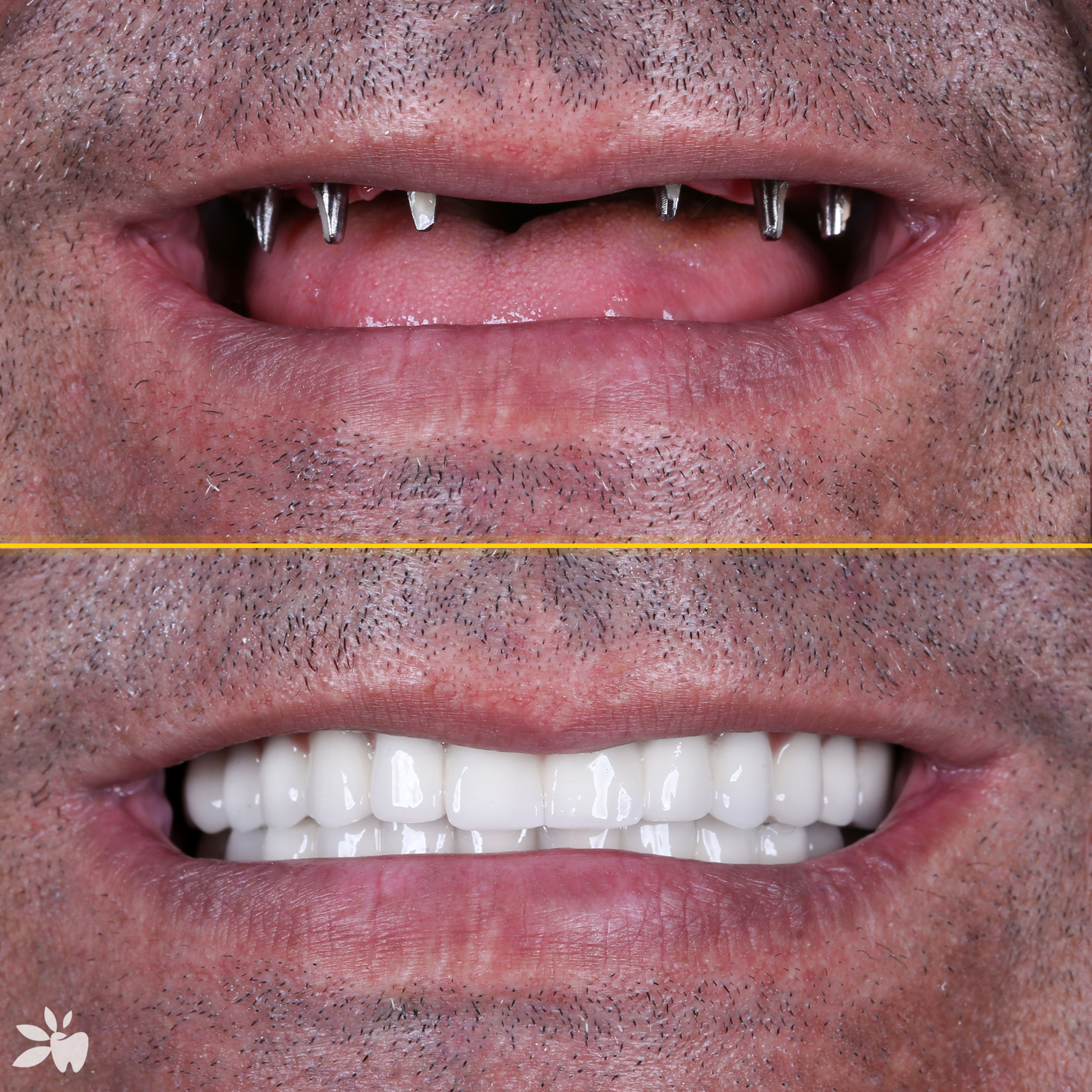 Ugur-before-after