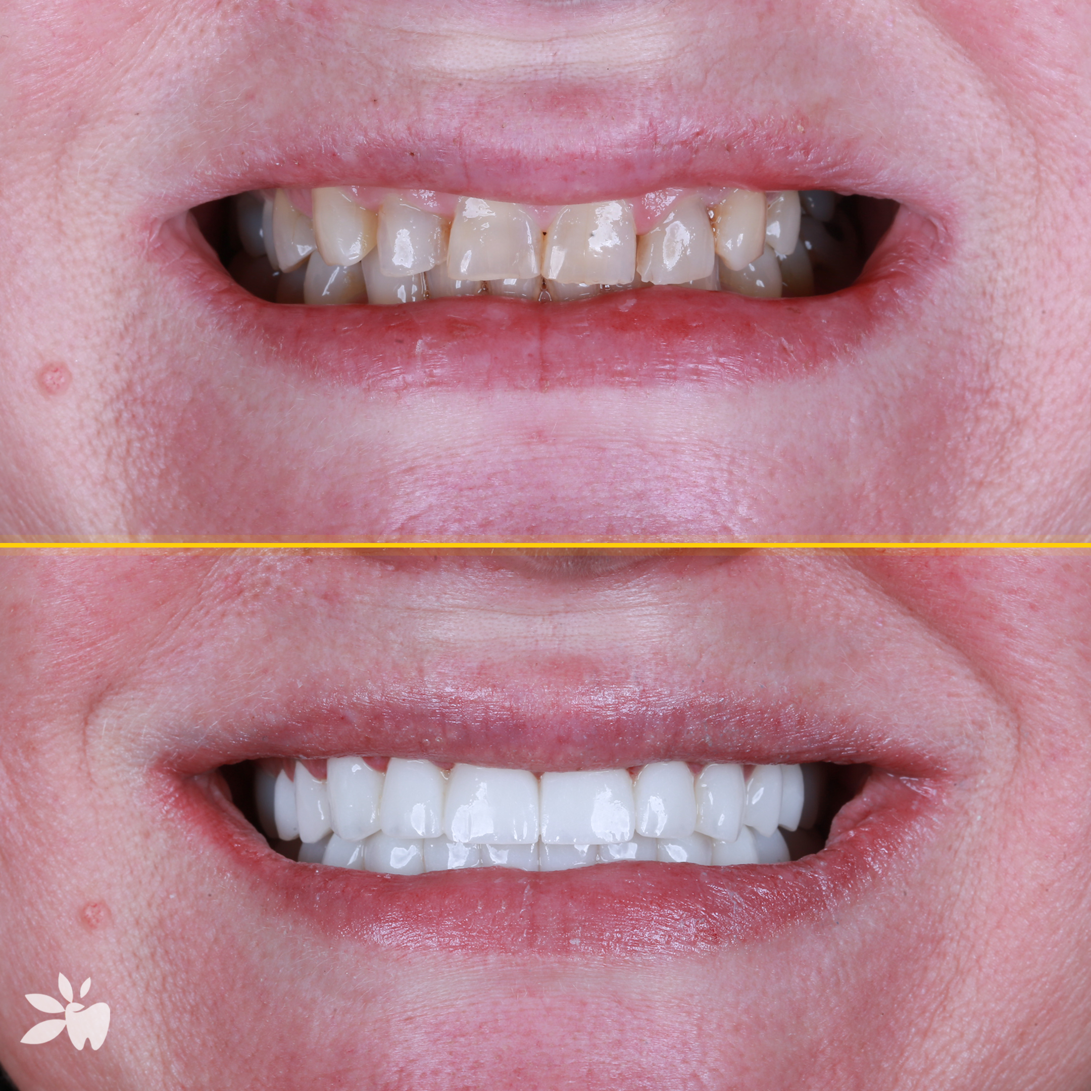Wanja-before-after-post