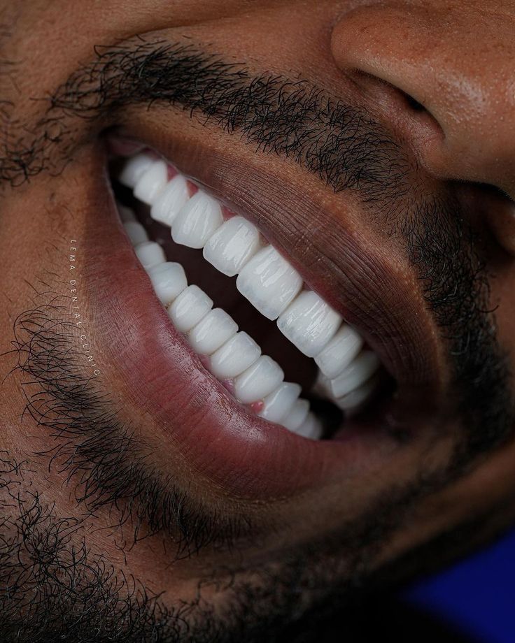 Smile Image