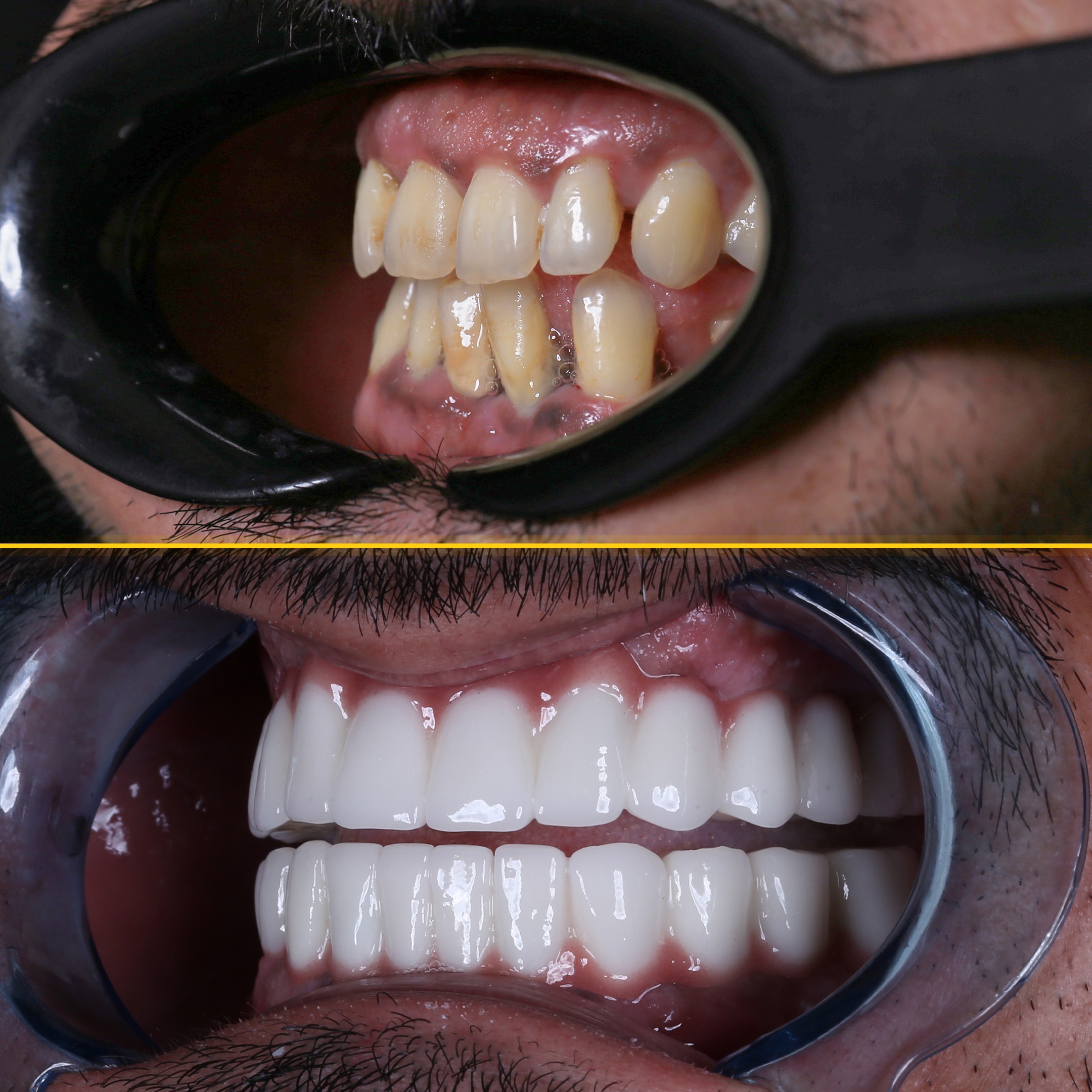 muhammed-before-after